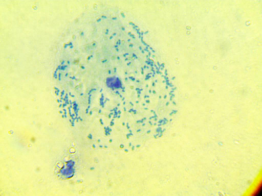 Cell under attack